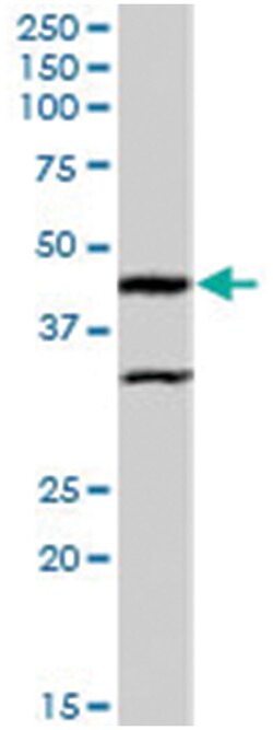 Actl7b, Goat, Polyclonal Antibody, Abnova 100&mu;g; Unlabeled:Antibodies,