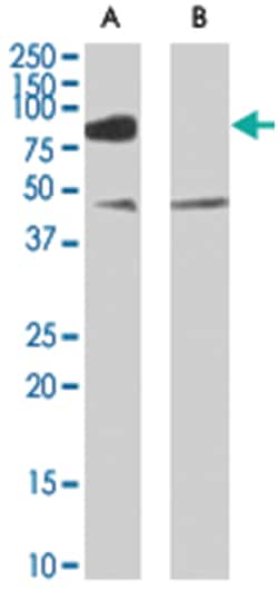 ZDHHC8, Goat, Polyclonal Antibody, Abnova 100 &mu;g | Buy Online | Abnova Corporation | Fisher Scientific