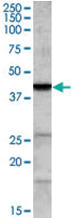 ABHD5, Goat, Polyclonal Antibody, Abnova 100&mu;g; Unlabeled:Antibodies,