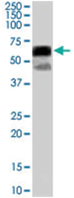 P4HA1, Goat, Polyclonal Antibody, Abnova 100 &mu;g | Buy Online | Abnova Corporation | Fisher Scientific