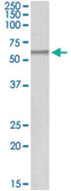 pnpla2, Goat, Polyclonal Antibody, Abnova 100 &mu;g | Buy Online | Abnova | Fisher Scientific