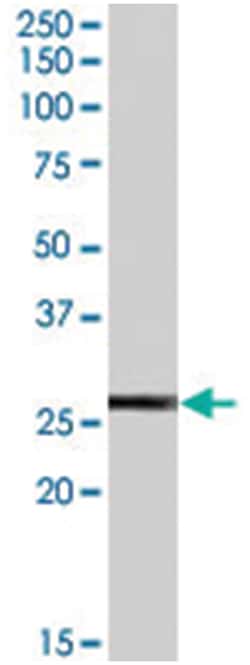 GPX3, Goat, Polyclonal Antibody, Abnova 100 &mu;g | Buy Online | Abnova Corporation | Fisher Scientific