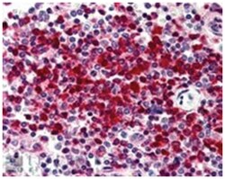 DKC1, Goat, Polyclonal Antibody, Abnova 100&mu;g; Unlabeled:Antibodies,