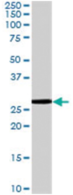 SMN1/SMN2, Goat, Polyclonal Antibody, Abnova 100&mu;g; Unlabeled:Antibodies,