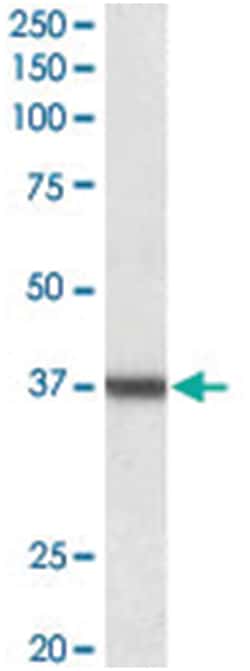 ARG1 Goat anti-Human, Mouse, Polyclonal Antibody, Abnova 100 &mu;g | Buy Online | Abnova | Fisher Scientific