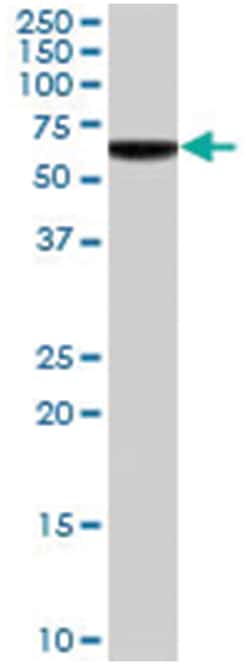 PLIN1 Goat anti-Human, Polyclonal Antibody, Abnova 100&mu;g; Unlabeled:Antibodies,