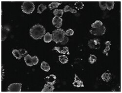 PLIN1 Goat anti-Human, Polyclonal Antibody, Abnova 100&mu;g; Unlabeled:Antibodies,