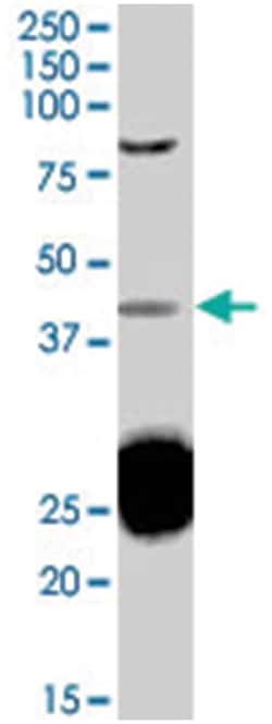 TIA1, Goat, Polyclonal Antibody, Abnova 100 &mu;g | Buy Online | Abnova Corporation | Fisher Scientific
