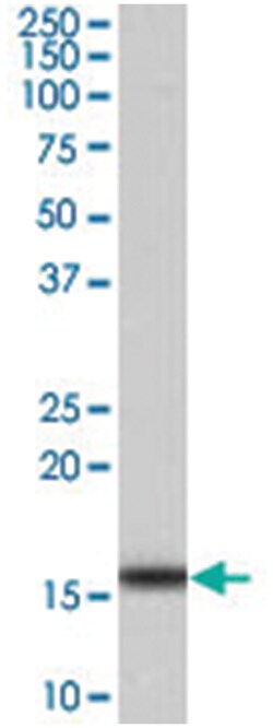 FABP2, Goat, Polyclonal Antibody, Abnova 100&mu;g; Unlabeled:Antibodies,