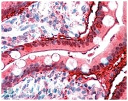 FABP2, Goat, Polyclonal Antibody, Abnova 100&mu;g; Unlabeled:Antibodies,