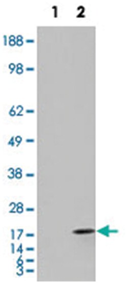 FABP2, Goat, Polyclonal Antibody, Abnova 100&mu;g; Unlabeled:Antibodies,