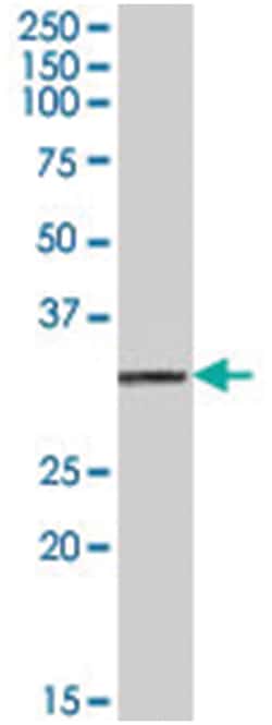PSME1, Goat, Polyclonal Antibody, Abnova 100&mu;g; Unlabeled:Antibodies,