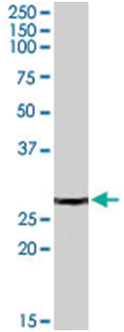 PSME2, Goat, Polyclonal Antibody, Abnova 100&mu;g; Unlabeled:Antibodies,