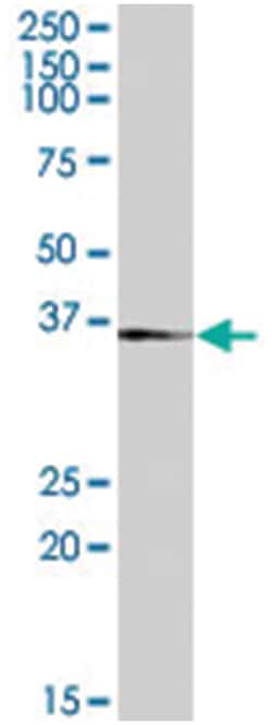TACR1, Goat, Polyclonal Antibody, Abnova 100 &mu;g | Buy Online | Abnova Corporation | Fisher Scientific