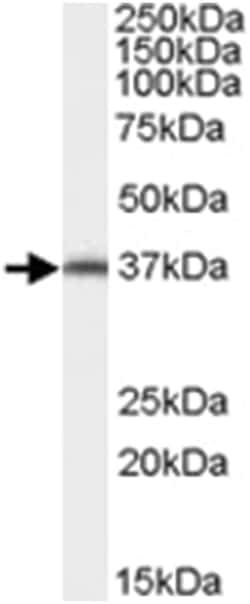AIP, Goat, Polyclonal Antibody, Abnova 100 &mu;g | Buy Online | Abnova Corporation | Fisher Scientific