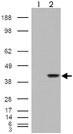 AIP, Goat, Polyclonal Antibody, Abnova 100 &mu;g | Buy Online | Abnova Corporation | Fisher Scientific