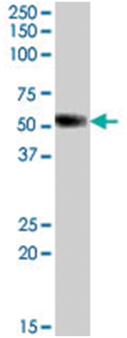 NR0B1, Goat, Polyclonal Antibody, Abnova 100&mu;g; Unlabeled:Antibodies,
