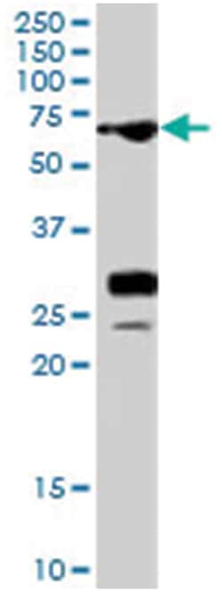 Sall4, Goat, Polyclonal Antibody, Abnova 100 &mu;g | Buy Online | Abnova Corporation | Fisher Scientific