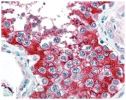 G6PD Goat anti-Human, Polyclonal Antibody, Abnova 100 &mu;g | Buy Online | Abnova Corporation | Fisher Scientific