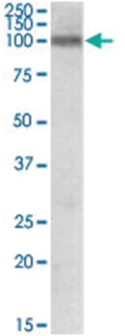 PPARGC1A, Goat, Polyclonal Antibody, Abnova 100&mu;g; Unlabeled:Antibodies,