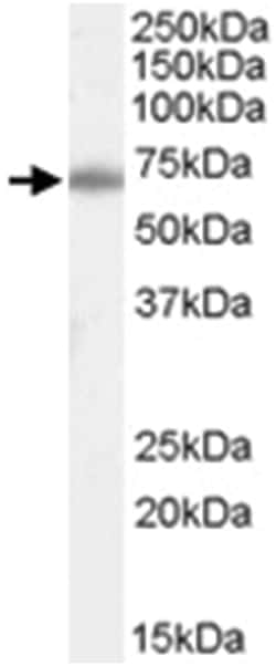 XRCC6, Goat, Polyclonal Antibody, Abnova 100 &mu;g | Buy Online | Abnova Corporation | Fisher Scientific
