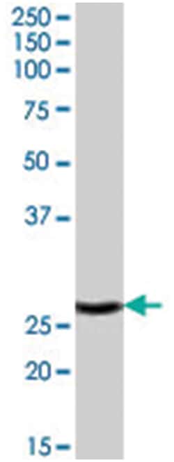 APH1A, Goat, Polyclonal Antibody, Abnova 100 &mu;g | Buy Online | Abnova Corporation | Fisher Scientific