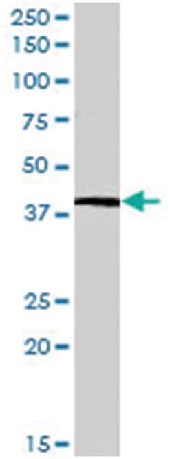 IL12b, Goat, Polyclonal Antibody, Abnova 100&mu;g; Unlabeled:Antibodies,