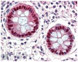 EGR2, Goat, Polyclonal Antibody, Abnova 100 &mu;g | Buy Online | Abnova Corporation | Fisher Scientific