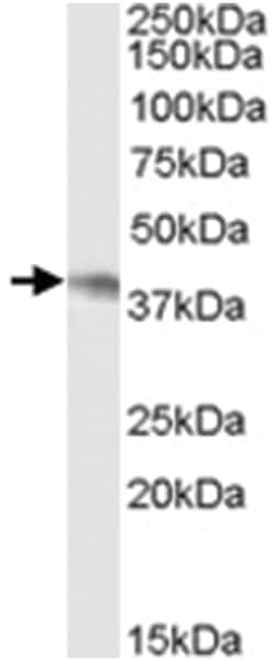 NCF4, Goat, Polyclonal Antibody, Abnova 100 &mu;g | Buy Online | Abnova Corporation | Fisher Scientific