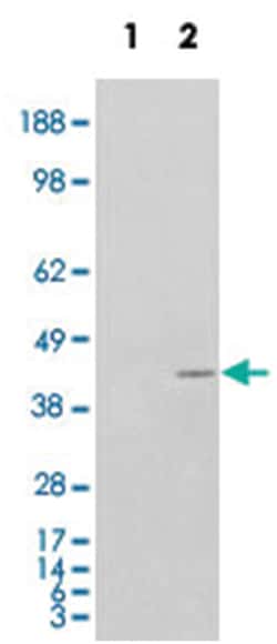 NCF4, Goat, Polyclonal Antibody, Abnova 100 &mu;g | Buy Online | Abnova Corporation | Fisher Scientific