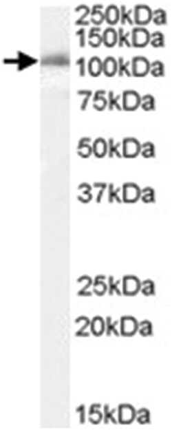 IDE Goat anti-Human, Polyclonal Antibody, Abnova 100&mu;g; Unlabeled:Antibodies,
