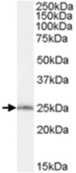SAR1B, Goat, Polyclonal Antibody, Abnova 100&mu;g; Unlabeled:Antibodies,