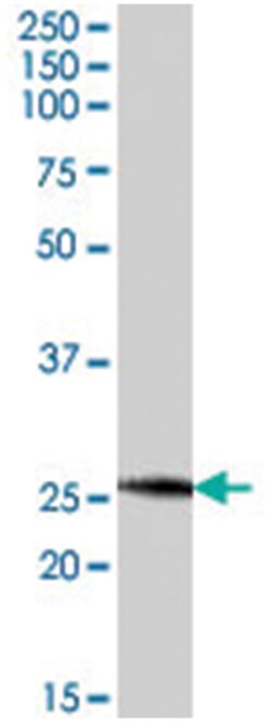 NRTN Goat anti-Human, Mouse, Polyclonal Antibody, Abnova 100 &mu;g | Buy Online | Abnova Corporation | Fisher Scientific
