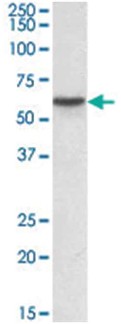 GC Goat anti-Human, Polyclonal Antibody, Abnova 100 &mu;g | Buy Online | Abnova | Fisher Scientific