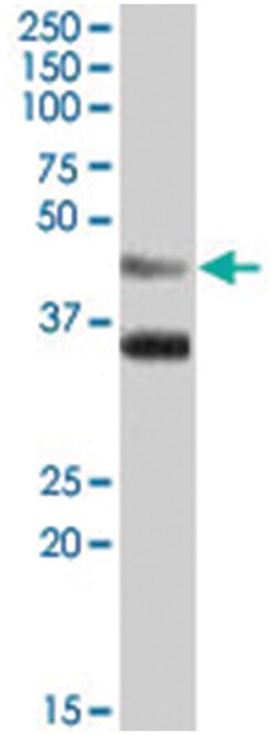 ARSB, Goat, Polyclonal Antibody, Abnova 100 &mu;g | Buy Online | Abnova | Fisher Scientific