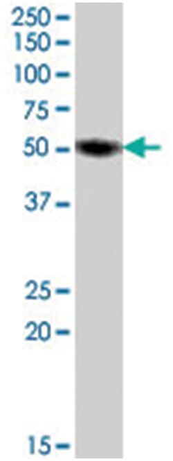EGR4, Goat, Polyclonal Antibody, Abnova 100&mu;g; Unlabeled:Antikroppar