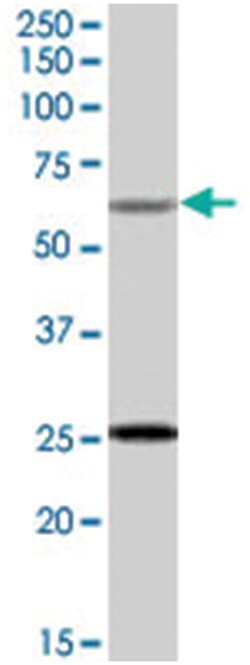 COL4A3BP Goat anti-Mouse, Polyclonal Antibody, Abnova 100&mu;g; Unlabeled:Antibodies,