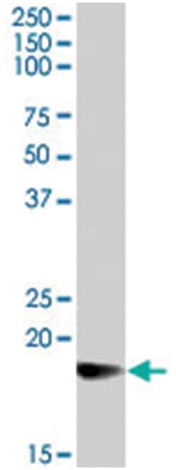 Goat anti-CRYAB, Polyclonal, Abnova 100 &mu;g | Buy Online | Abnova | Fisher Scientific