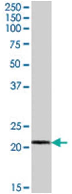 ARMET, Goat, Polyclonal Antibody, Abnova 100&mu;g; Unlabeled:Antibodies,