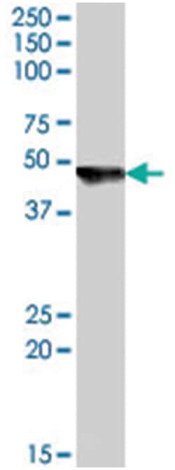 CYTH2, Goat, Polyclonal Antibody, Abnova 100&mu;g; Unlabeled:Antibodies,
