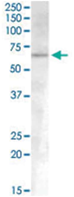 ACVR1, Goat, Polyclonal Antibody, Abnova 100 &mu;g | Buy Online | Abnova | Fisher Scientific