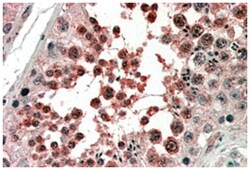 ACVR1, Goat, Polyclonal Antibody, Abnova 100 &mu;g | Buy Online | Abnova | Fisher Scientific