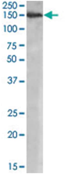 MAN2A1, Goat, Polyclonal Antibody, Abnova 100&mu;g; Unlabeled:Antibodies,