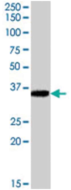 AKR1B10, Goat, Polyclonal Antibody, Abnova 100&mu;g; Unlabeled:Antibodies,
