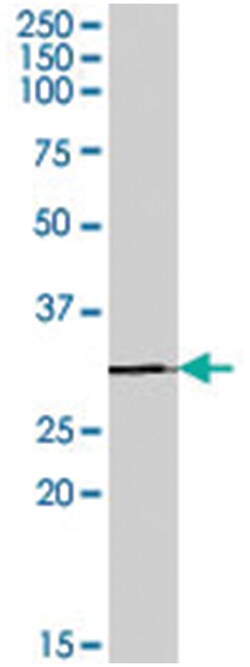 IGFBP4, Goat, Polyclonal Antibody, Abnova 100&mu;g; Unlabeled:Antibodies,