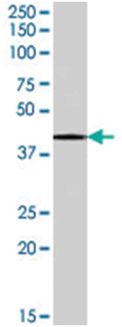 SERPINB6, Goat, Polyclonal Antibody, Abnova 100 &mu;g | Buy Online | Abnova Corporation | Fisher Scientific