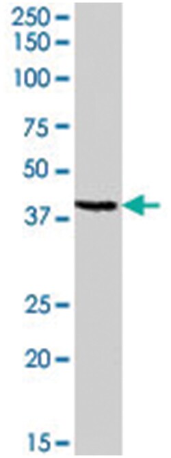 GPR119, Goat, Polyclonal Antibody, Abnova 100&mu;g; Unlabeled:Antibodies,