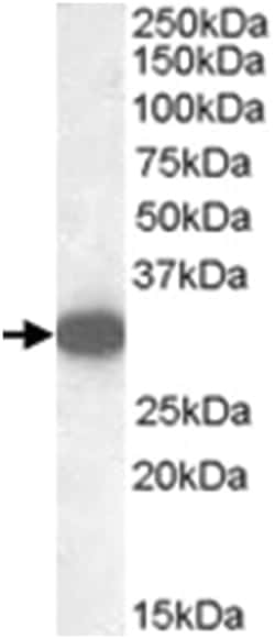 MGLL, Goat, Polyclonal Antibody, Abnova 100&mu;g; Unlabeled:Antibodies,