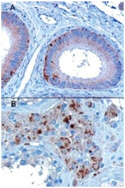 VPS35, Goat, Polyclonal Antibody, Abnova 100&mu;g; Unlabeled:Antibodies,