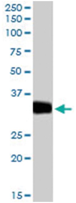 LDHC Goat anti-Mouse, Polyclonal Antibody, Abnova 100&mu;g; Unlabeled:Antibodies,